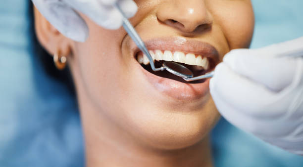Best Broken or Cracked Tooth Emergency Dentist in Smithton, IL
