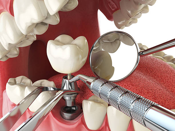 Best Pediatric Emergency Dentist in Smithton, IL